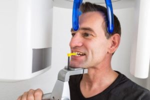 cbct-icat-dental-imaging