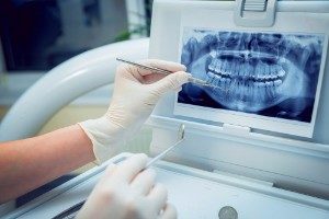 Dentofacial Orthopedics
