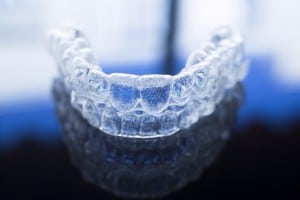 Invisalign