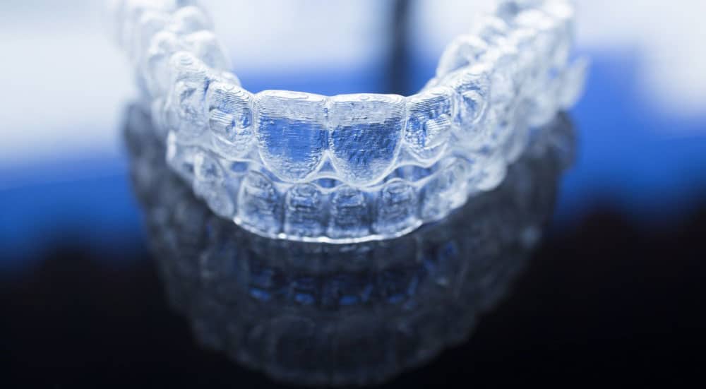 The Path To Perfect Teeth – 5 Must Know Invisalign Tips