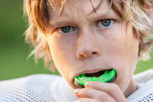 Sports Mouth Guards in Buffalo, NY | Orthodontists Associates of WNY