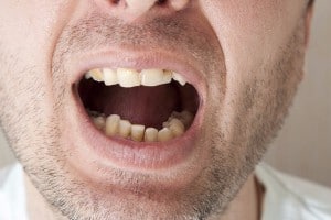 You Could Be Grinding Your Teeth Without Realizing It.