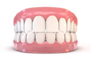 Ideal Bite - What Does It Look Like Orthodontists Associates of WNY