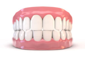 Ideal Bite - What Does It Look Like Orthodontists Associates of WNY