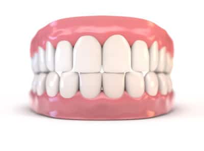 Ideal Bite - What Does It Look Like Orthodontists Associates of WNY