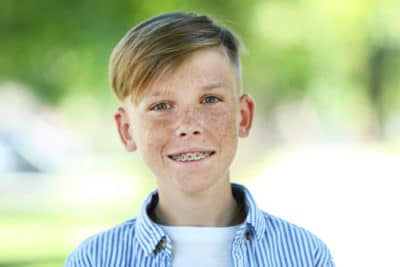 Best Age for Braces Child Orthodontist Orthodontists Associates of WNY