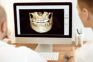 i-CAT Digital Imaging Dental X-Ray Cone Beam CT Free Consultation