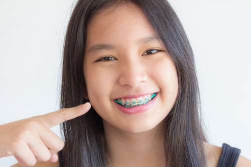 What is Bullying and How Do You Stop It? - Invisalign Clear Aligners &  Braces