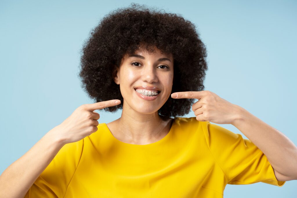 Benefits of Clear Braces in Buffalo, NY | Free Consults [Video Q&A]