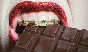 Eating with Braces Alternatives to Foods You Can’t Eat Orthodontists