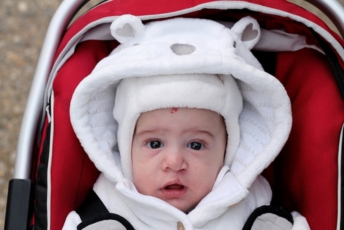Cleft Lip Treatments: Craniofacial Orthodontics | Free Consultations