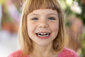 Do Crooked Baby Teeth Need Treatment Free Consultations