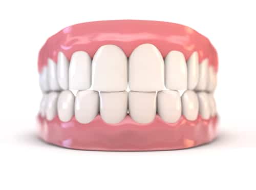 What is the Ideal Teeth Bite WNY Orthondontists Free Consultations