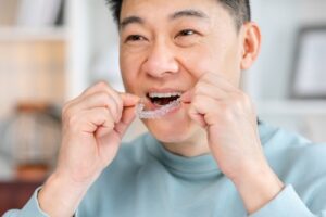 Price of Invisalign in Buffalo, NY | Book a Free Screening