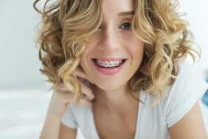 Braces Hurt Less Thank You Think | Orthodontics in Buffalo, NY