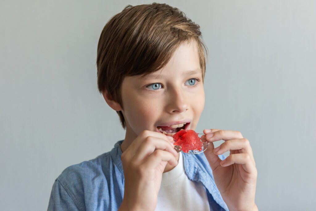 Dental Expander in Buffalo, NY | Free Consultations [Video Guide]