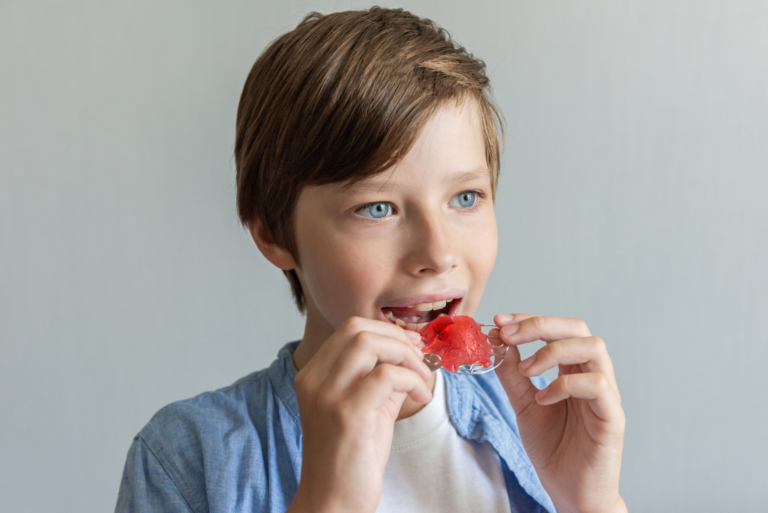 Dental Expander in Buffalo, NY | Free Consultations [Video Guide]