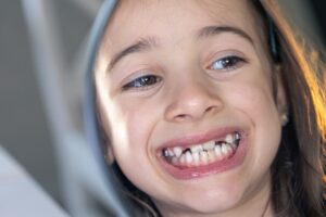 Braces With Missing Teeth in Buffalo, NY [Video Explainer]