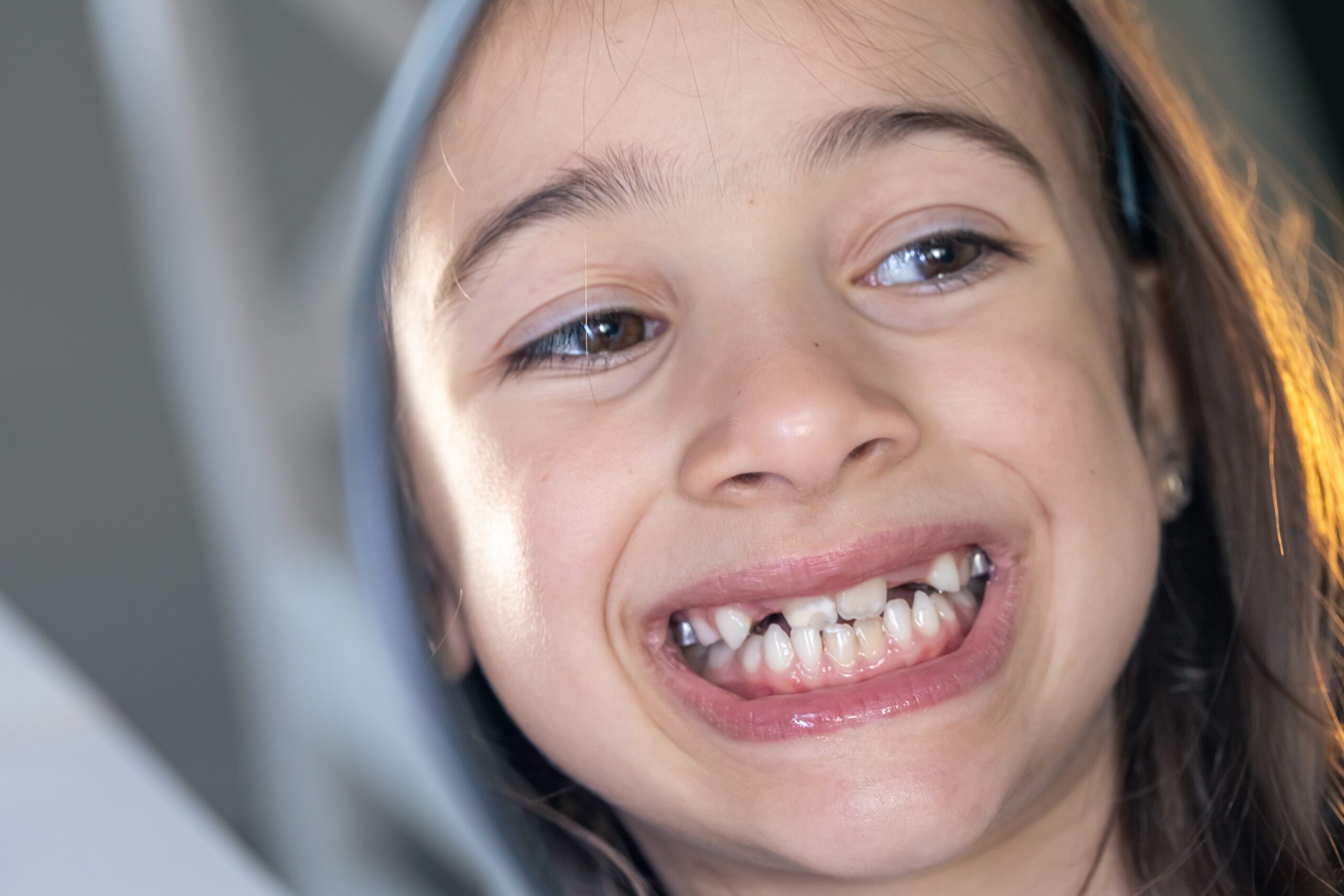 Braces With Missing Teeth in Buffalo, NY [Video Explainer]