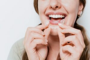 Invisalign Dentist in Buffalo, NY | Clear Aligner Consult [Video Q&A]
